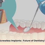 screwless_dental_implants_edited