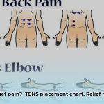 tens_electrode_placement_chart_pdf_edited