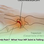 thumb_mp_joint_edited