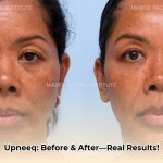 upneeq_before_and_after_edited