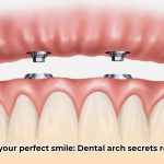 what_is_a_dental_arch_edited