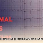 what_is_borderline_ecg_edited