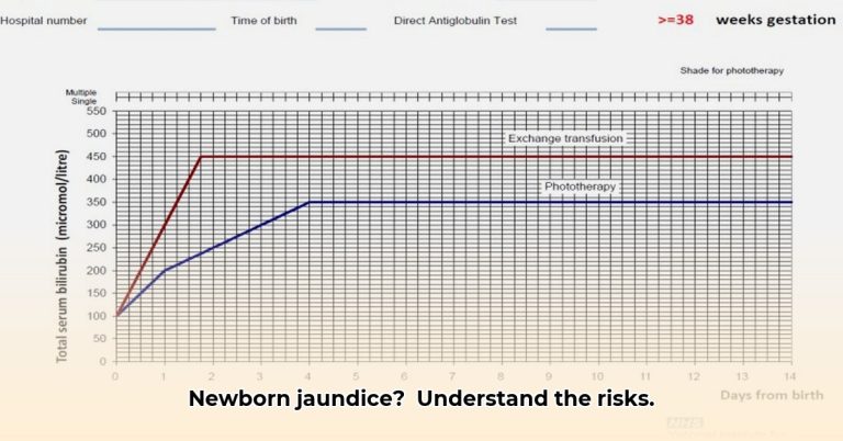 Understand Phototherapy Threshold Bilirubin: Updated Guidelines for ...