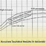transcutaneous_bilirubin_scan_edited